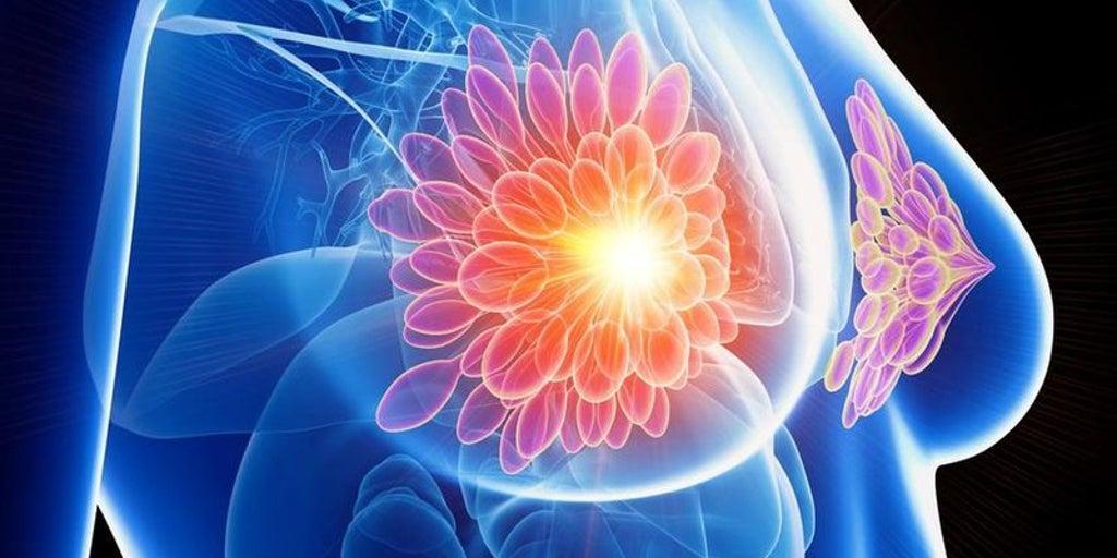 It is the entire gene row of women suffering from breast cancer