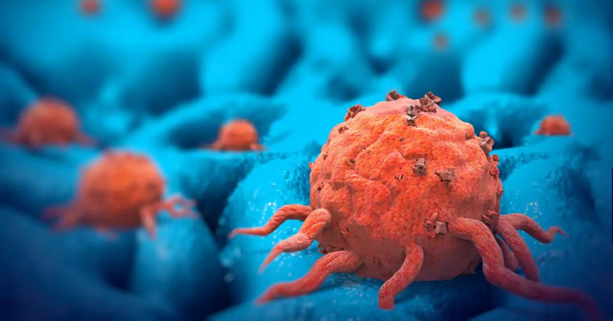 Esta vacuna experimental puede cambiar el cáncer panchantítico, en lugar de veni...